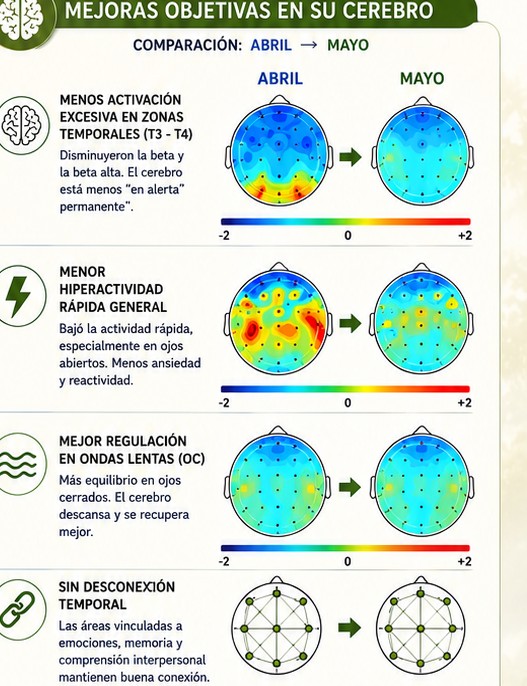 Mapas cerebrales QEEG de Rodrigo, comparación abril y mayo